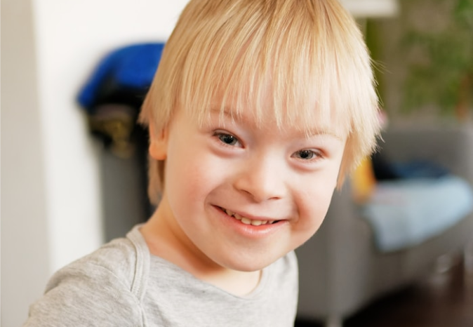 Retrato de un niño con síndrome de Down